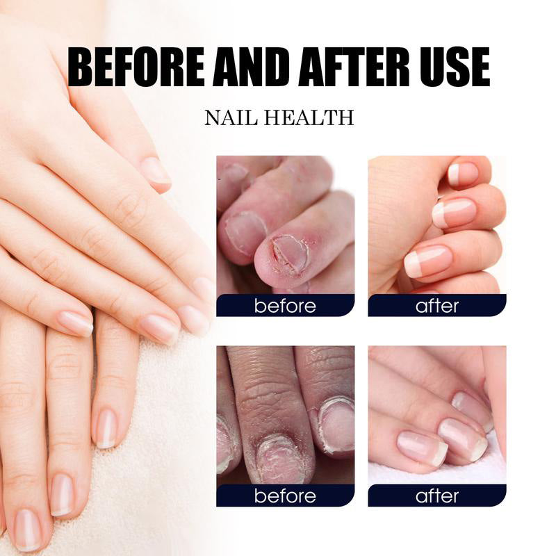 Nail Care Solution